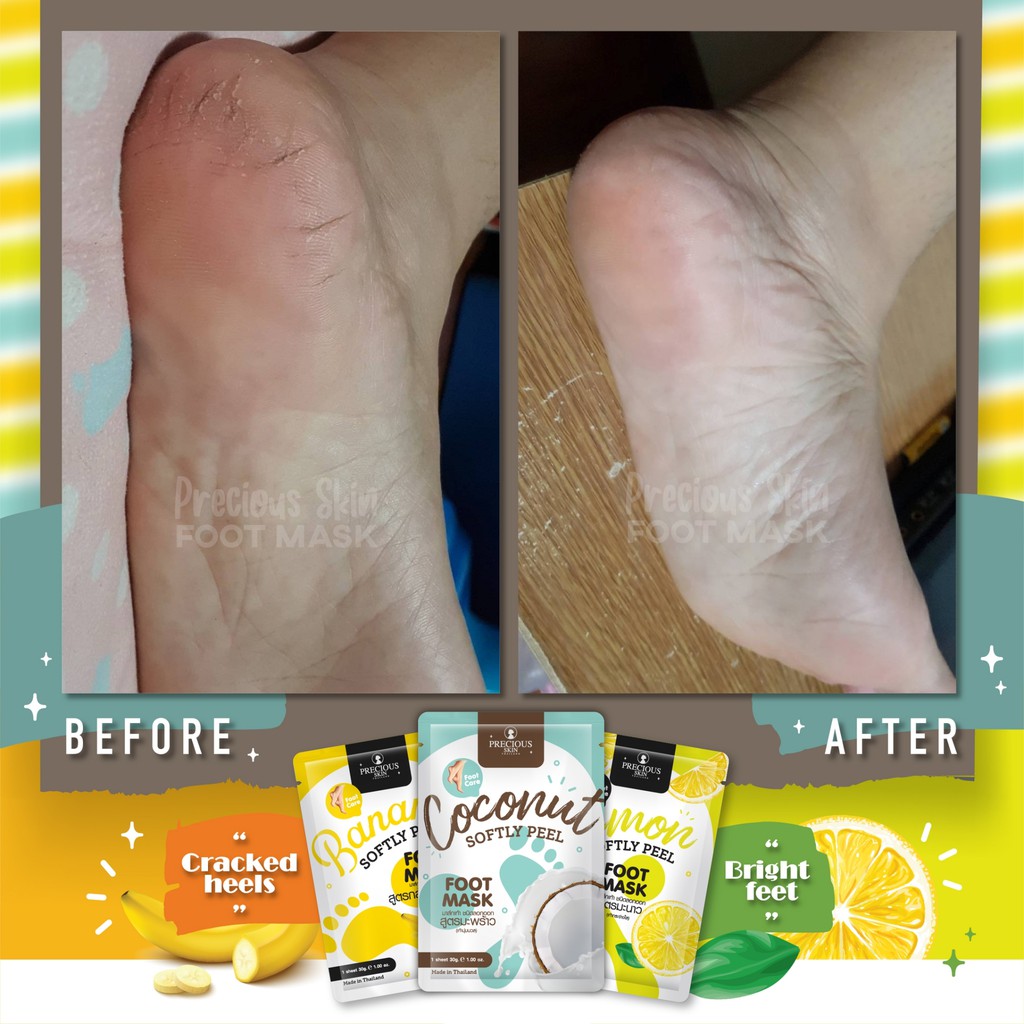 Precious Skin Thailand Coconut Softly Peel Foot Mask,Precious Skin Thailand ,Coconut Softly Peel Foot Mask,มาสก์เท้าCoconut Softly Peel Foot Mask,ราคามาสก์เท้าCoconut Softly Peel Foot Mask,วิธีใช้มาสก์มาสก์เท้าCoconut Softly Peel Foot Mask,รีวิวมาสก์มาสก์เท้าCoconut Softly Peel Foot Mask,มาสก์เท้า